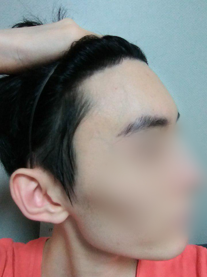 01.김재환_수술10달.jpg