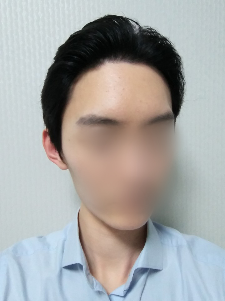 01.김재환_수술9달.jpg