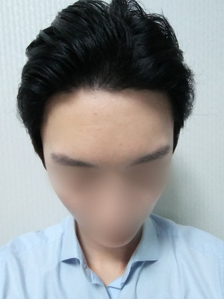 04.김재환_수술9달.jpg