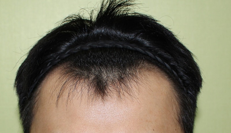 수술전.jpg