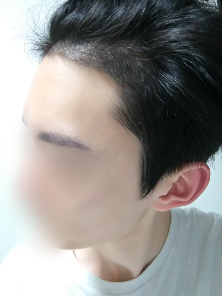 05.수술네달.jpg