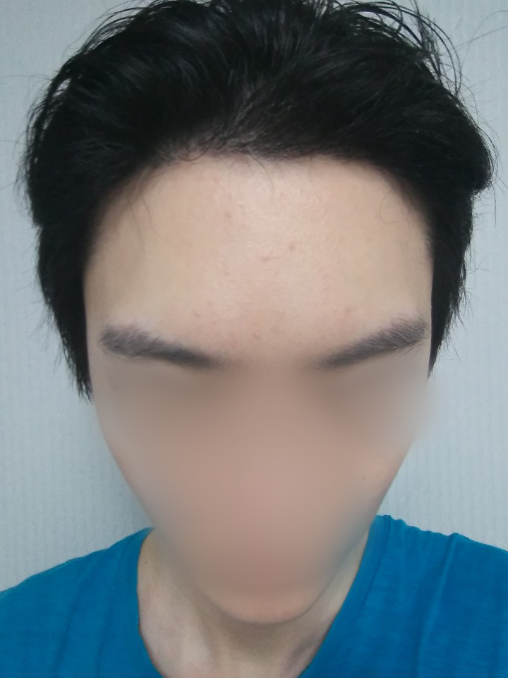 06.김재환 6달.jpg