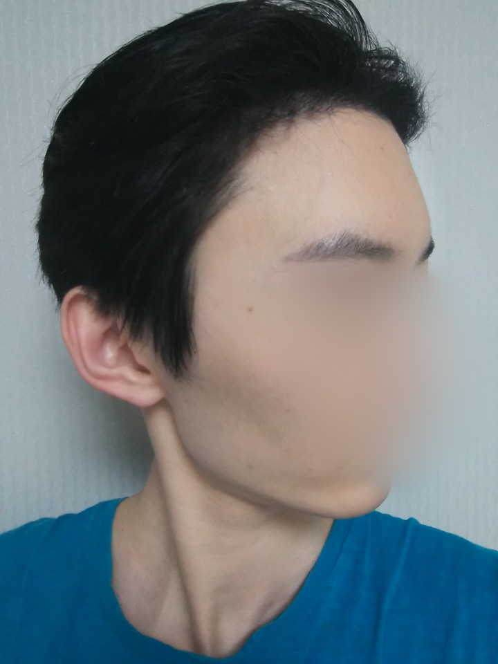 04.김재환 6달.jpg