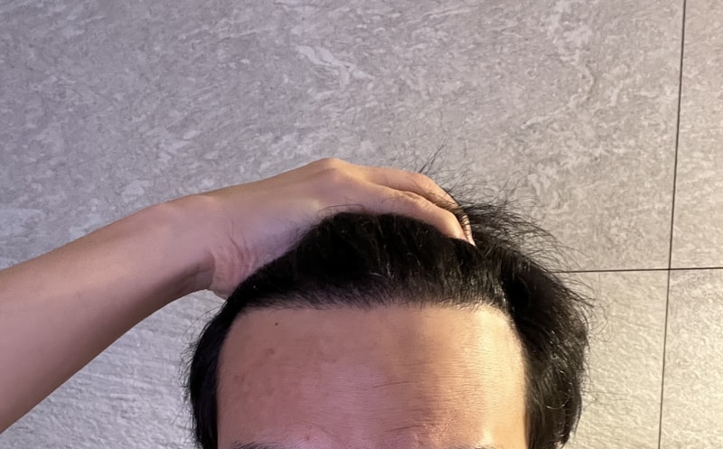다나 9개월 경과