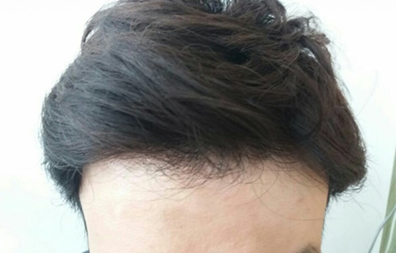 후2.jpg