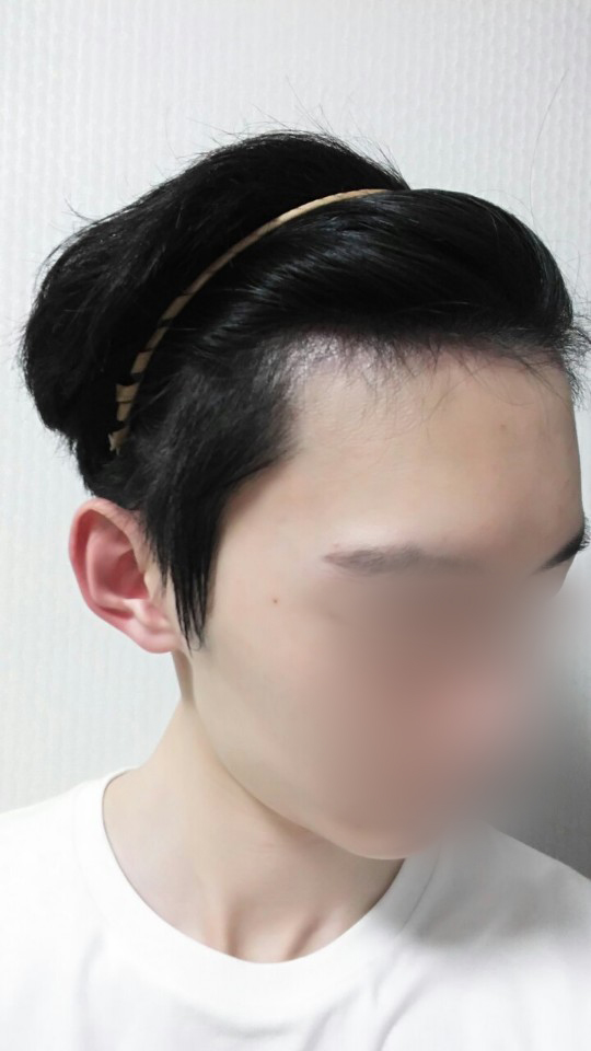 05.수술 두달4.jpg
