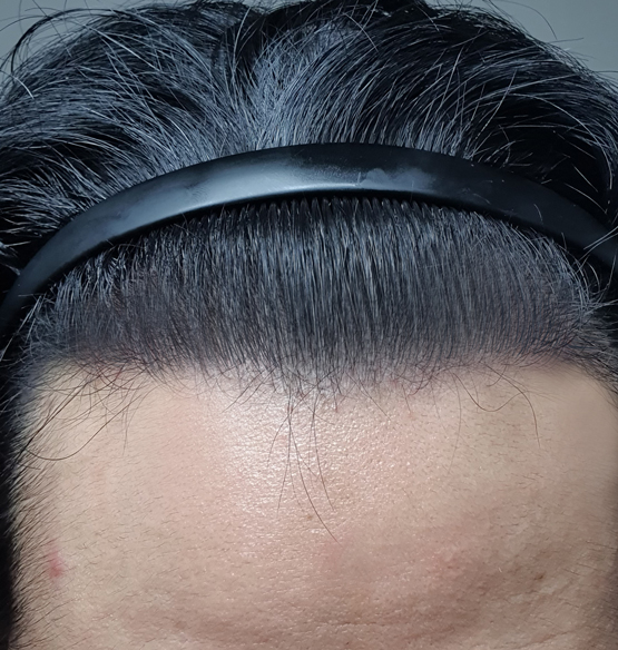 14개월 정면에서.jpg