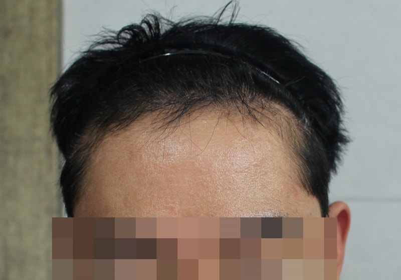 4개월 1.JPG