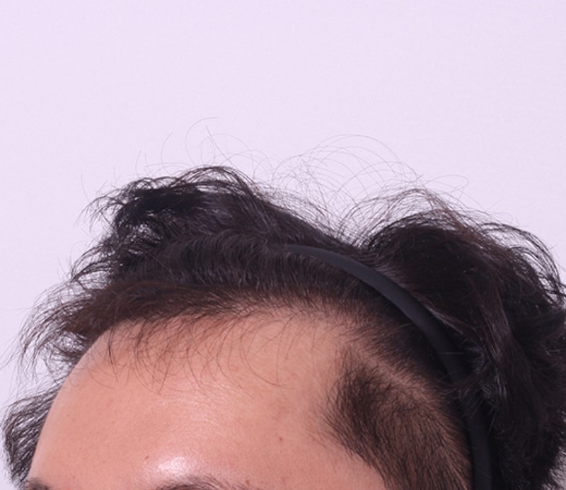 전2.jpg