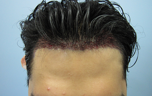 3.JPG
