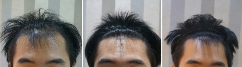 a.jpg
