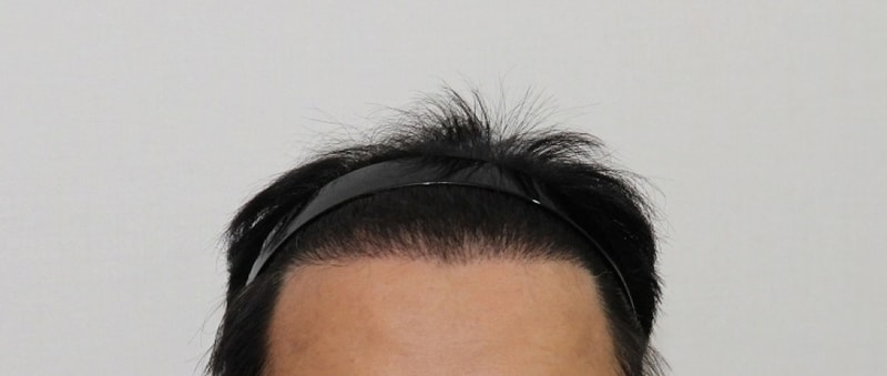 수술 후01.jpg