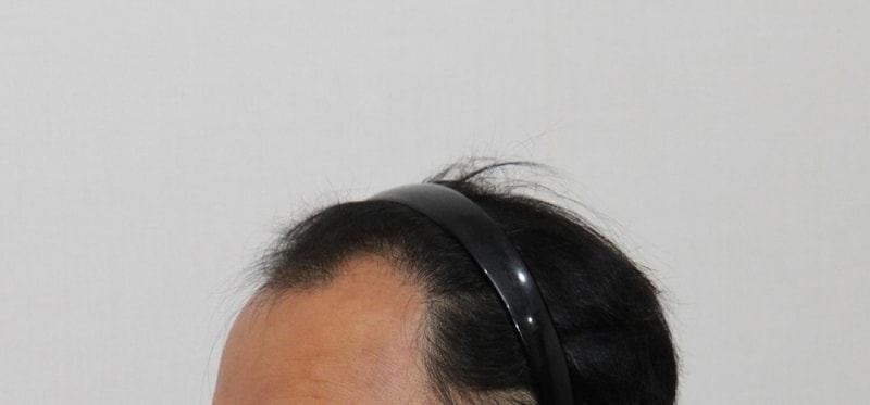수술 전02.jpg