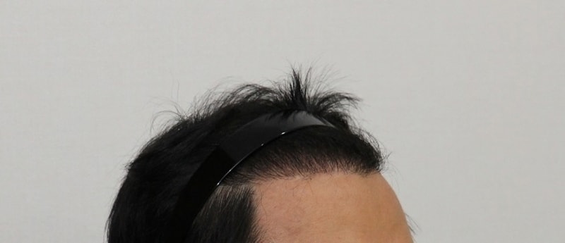 수술 후03.jpg