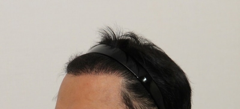 수술 후02.jpg