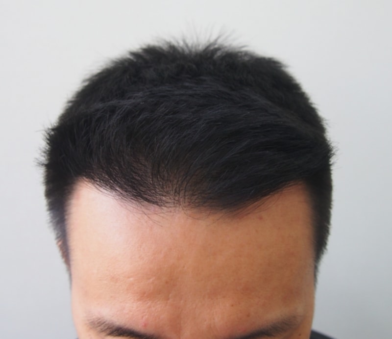 8개월정면.png