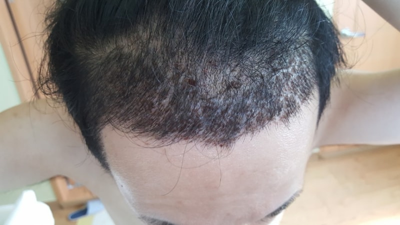 KakaoTalk_20170909_124334485.jpg