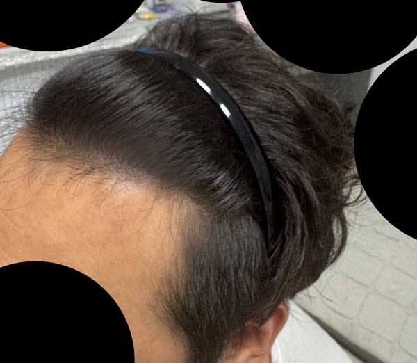 1년차옆모습.jpg
