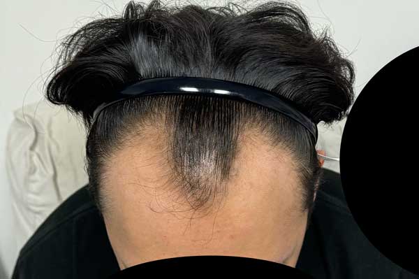 수술전 심각상태어쩔.jpg