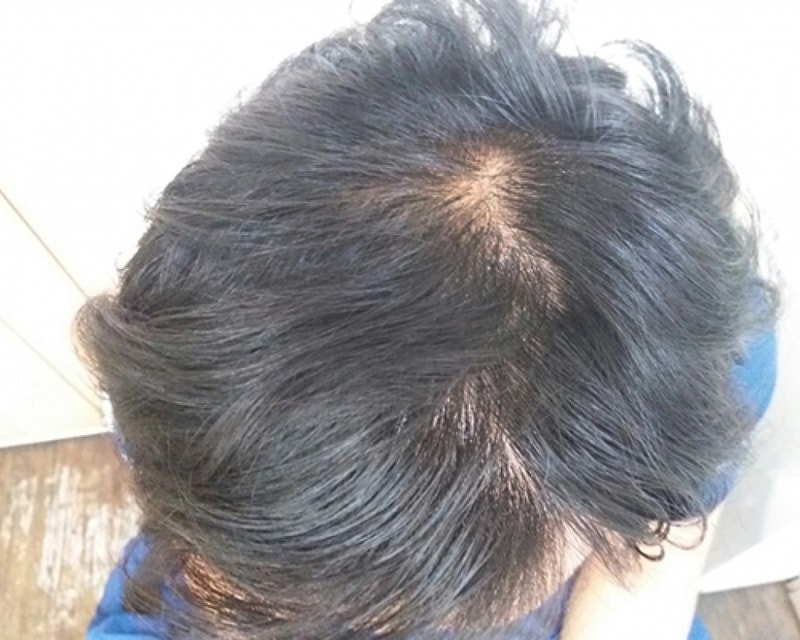 수술후.jpg