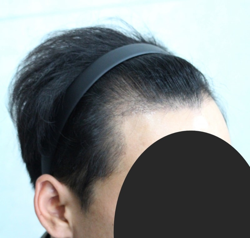 3개월 (4).JPG