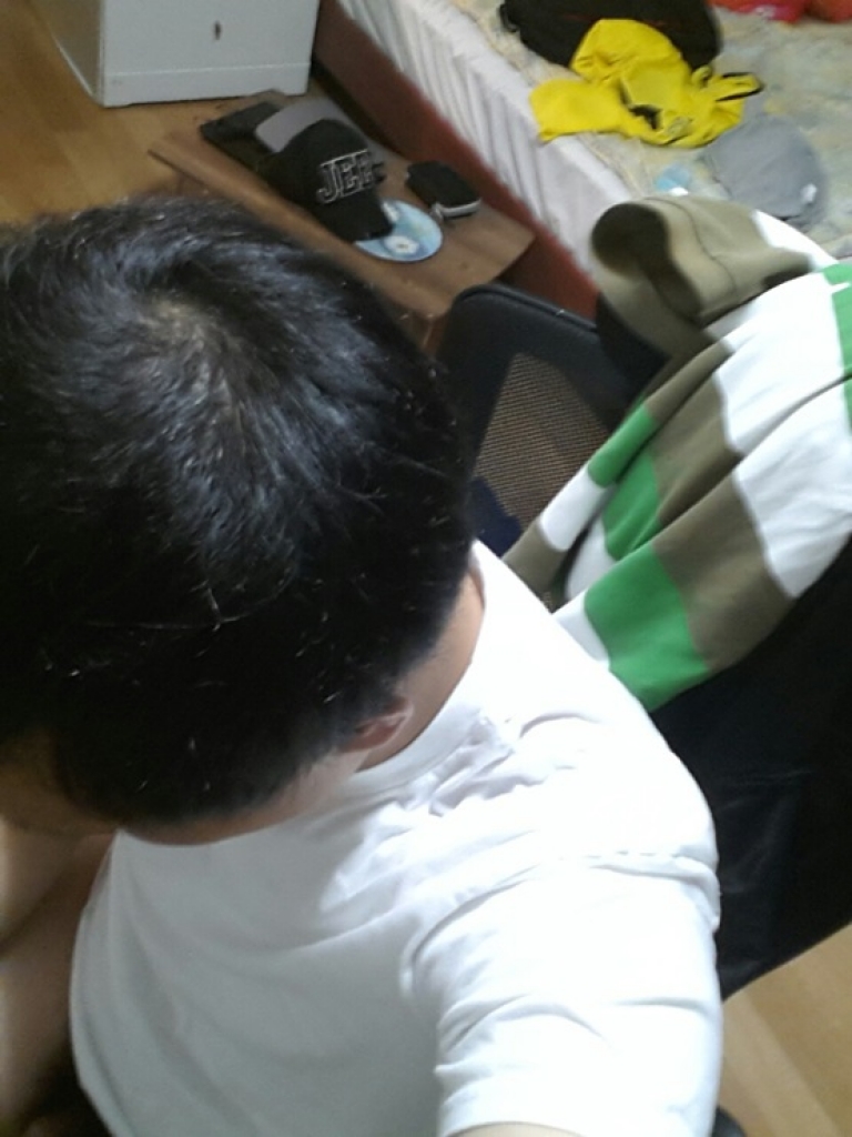 5)술후6개월 (8).jpg