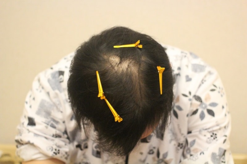 1)술전사진 (4).JPG