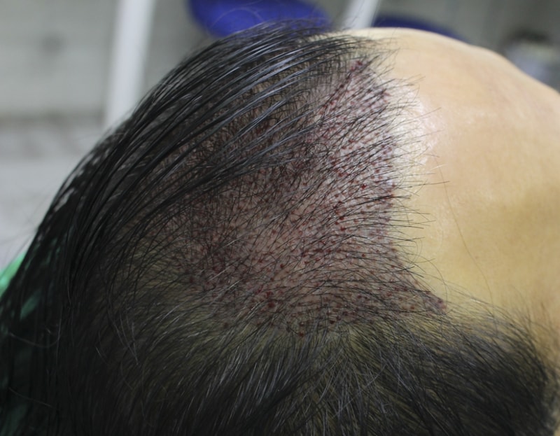 김 규선_20130915_모발_123329.png