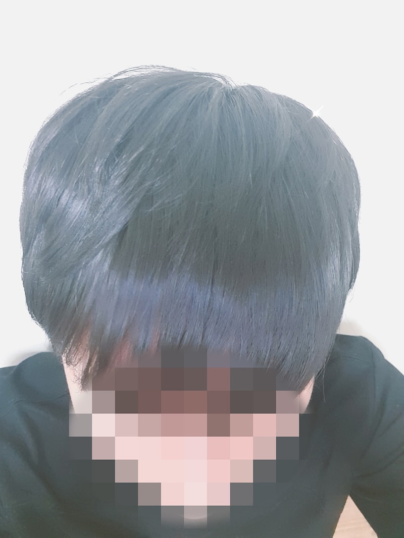 01.수술전.jpg