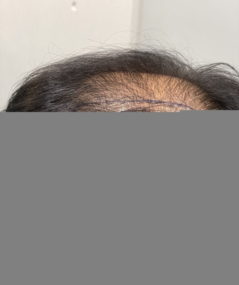 병원에서...jpg