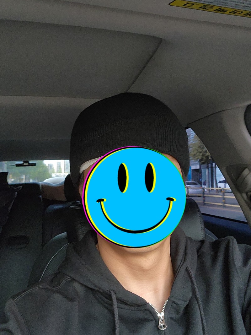 모발이식하고옴 9.jpg