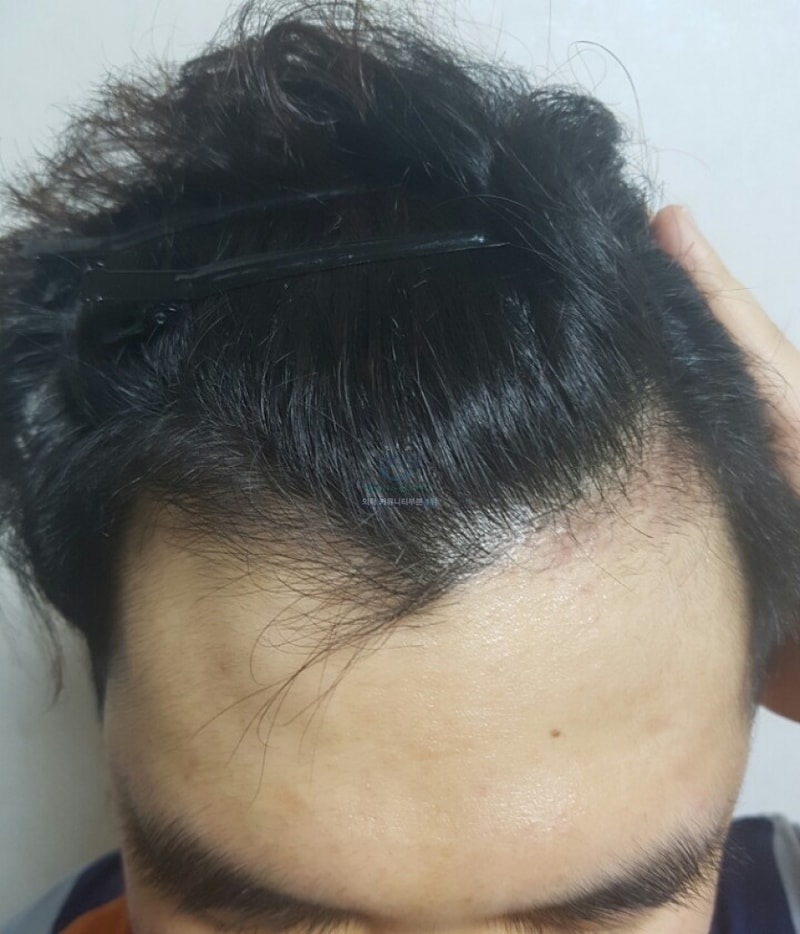 4개월.jpg