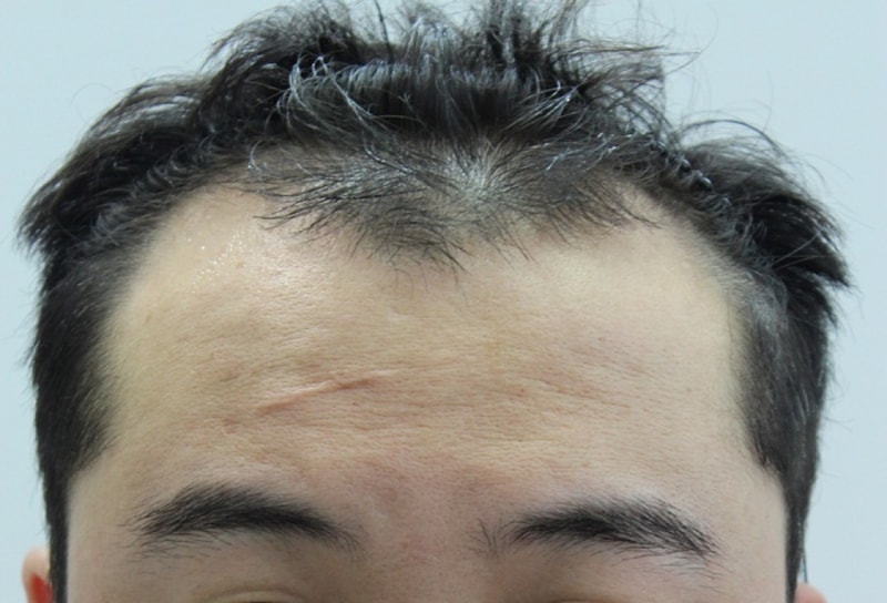 사진 003.jpg