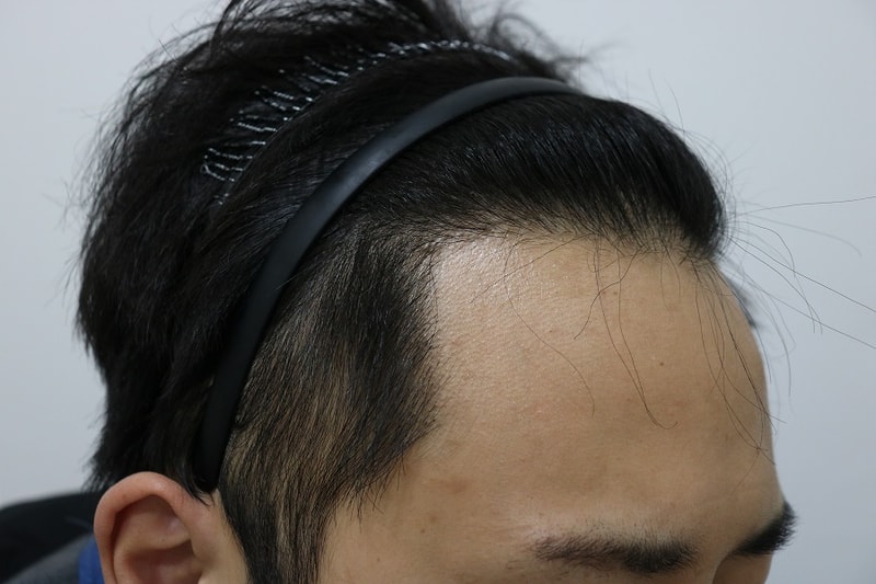 1년옆.jpg