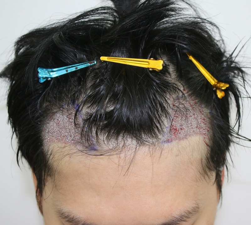 후1.JPG