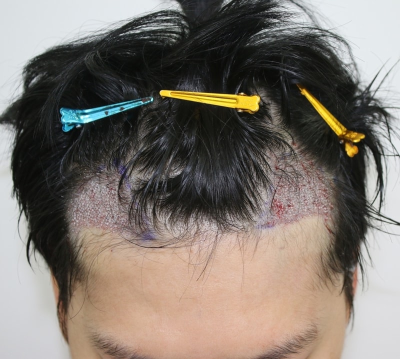 후1.JPG