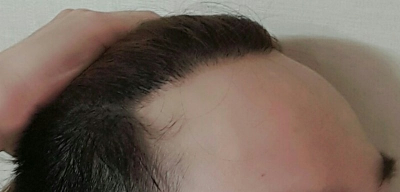 11개월1.jpg