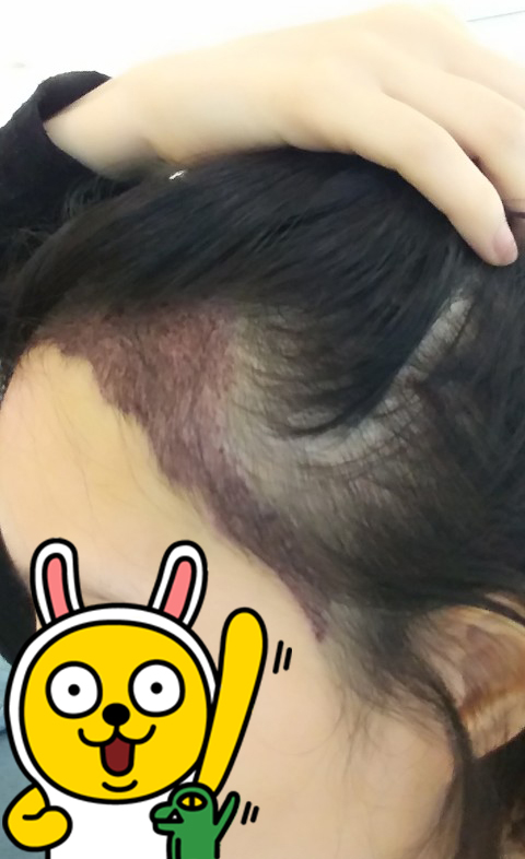 180315셀카 (8).jpg