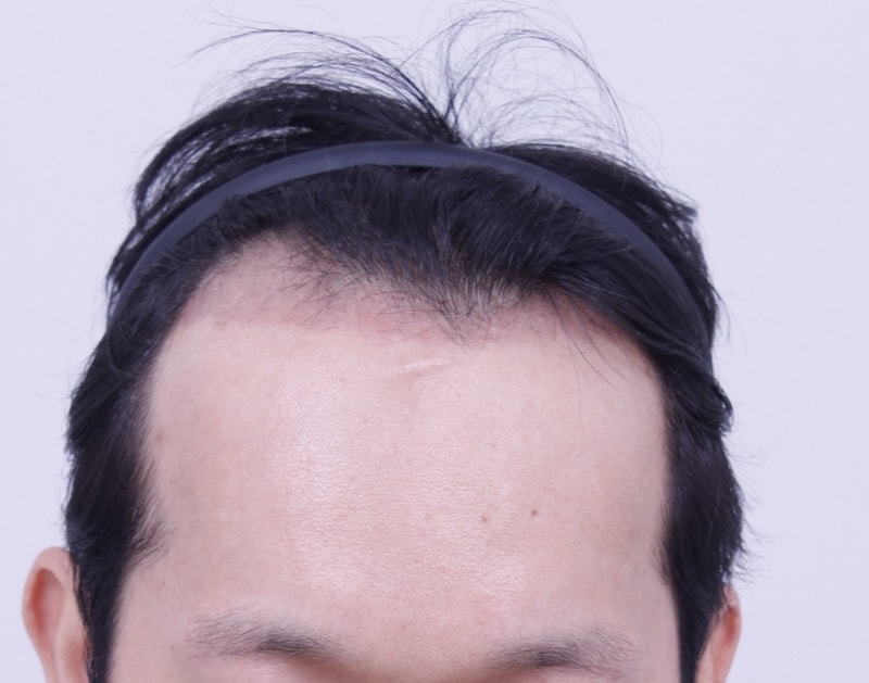 3주1.JPG
