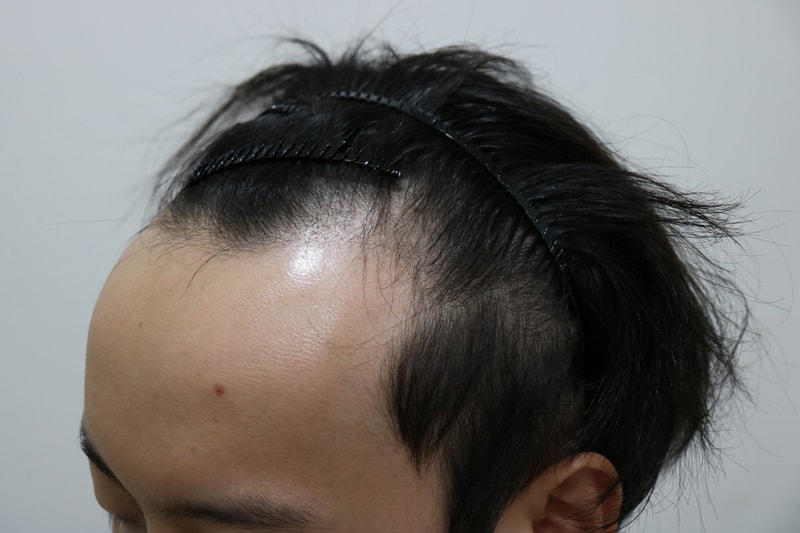 3.JPG