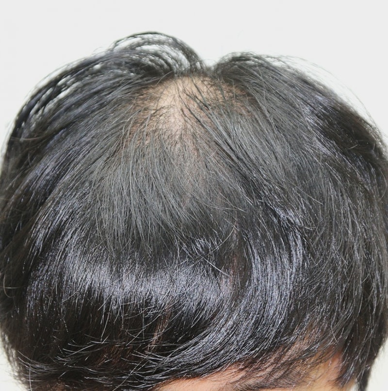 원형1.JPG