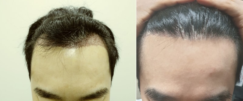 정면.png