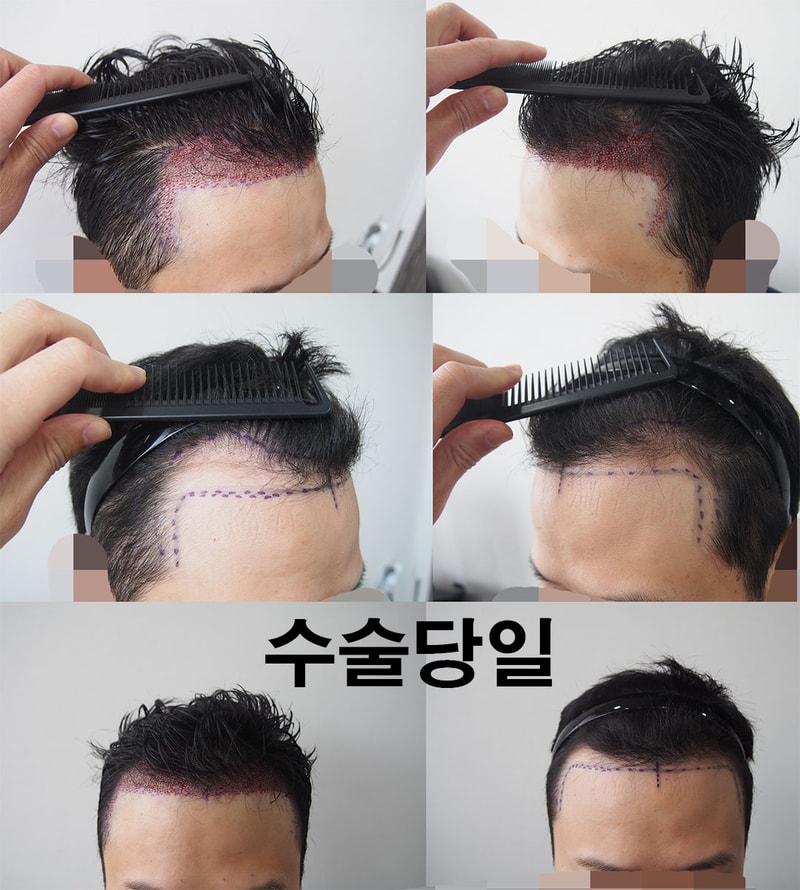 모재성 당일~ 18일 후기입니다.