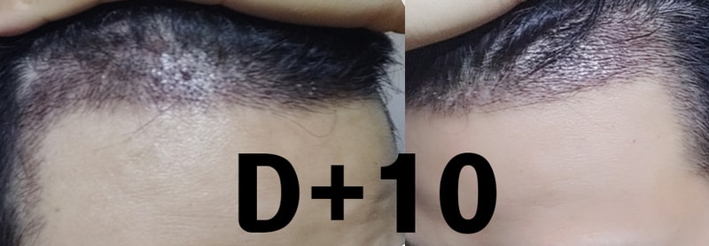 D10.jpg