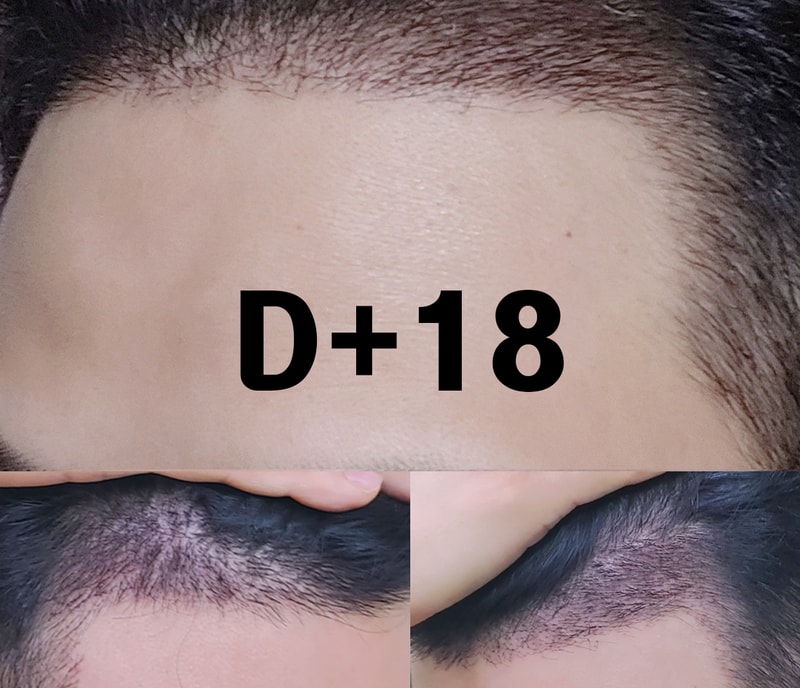D18.jpg