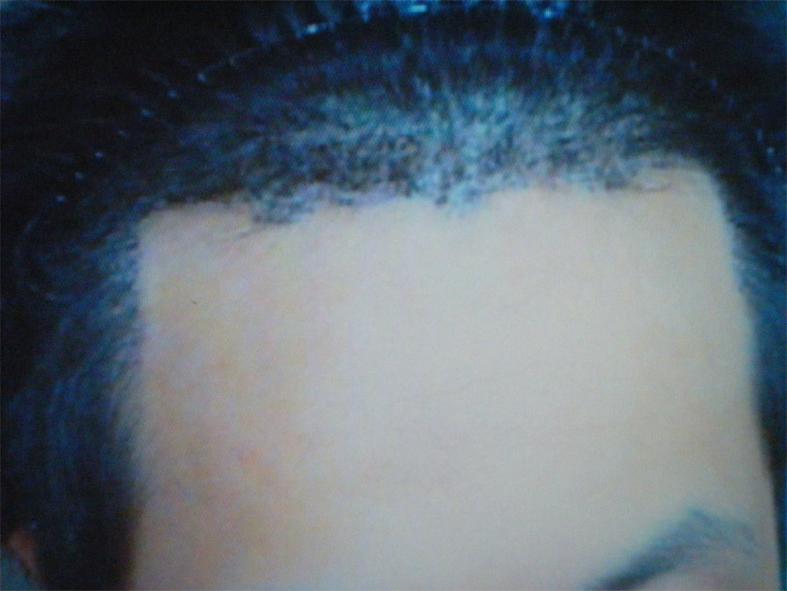 술후 copy.jpg