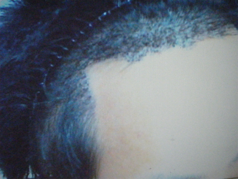 술후옆 copy.jpg