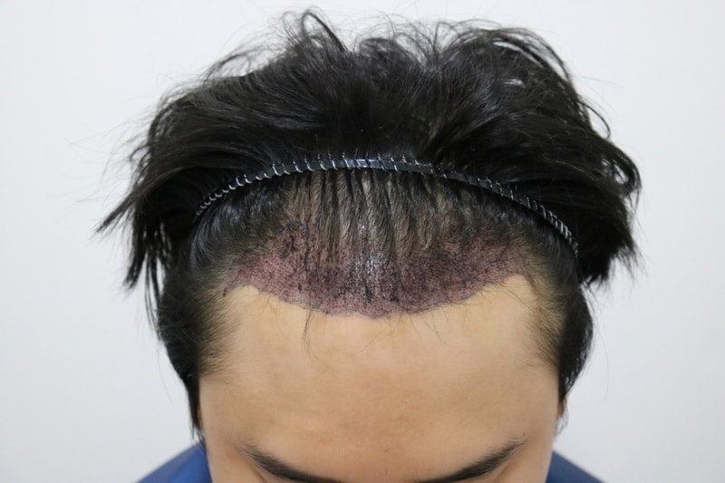mo after0.jpg