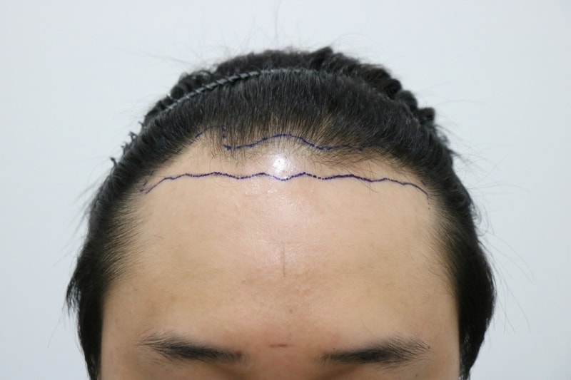 mo before line1.jpg