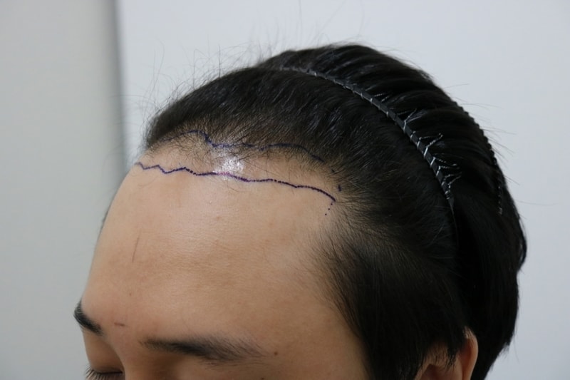 mo before line2.jpg